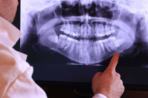 Best Dentist for Tooth Abscess  in Breaux Bridge, LA