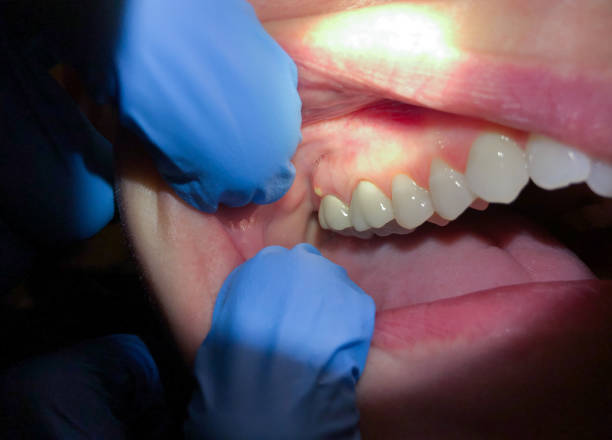 Dentist for Dental Trauma in LA