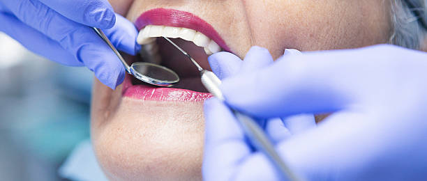 Best Knocked-Out Tooth Emergency  in Breaux Bridge, LA